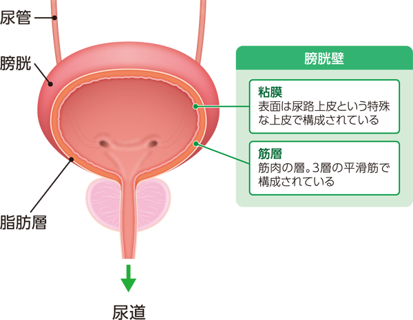 膀胱 の 壁 が 厚く なる 原因