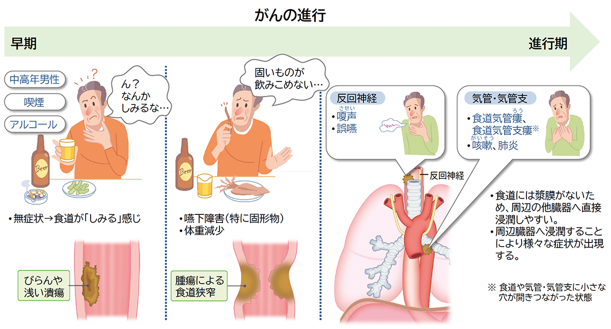 食道 やけど 症状