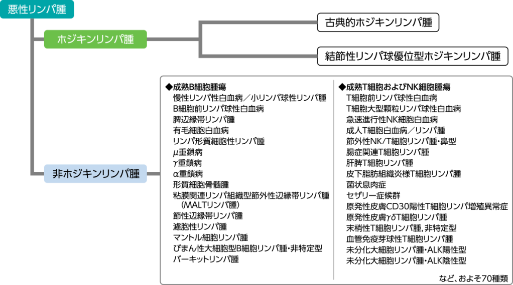 悪性リンパ腫の種類