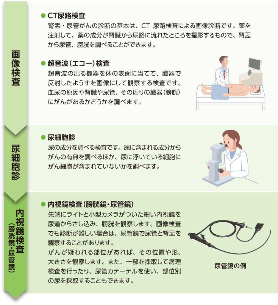 腎盂・尿管がんの確定診断までの流れ