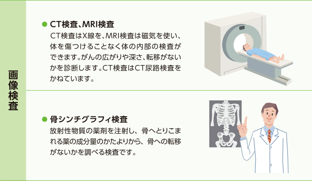 治療方針を決めるための検査