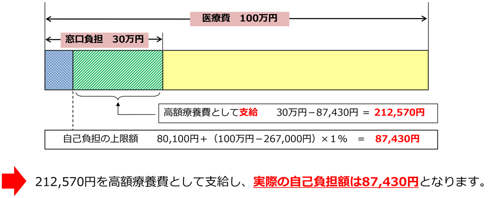 高額療養費として支給　30万円－87,430円=212,570円 負担の上限額　80,100円＋（100万円－267,000円）×1％=87,430円 →212,570円を高額療養費として支給し、実際の自己負担額は87,430円となります。