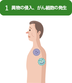 1.異物の侵入、がん細胞の発生