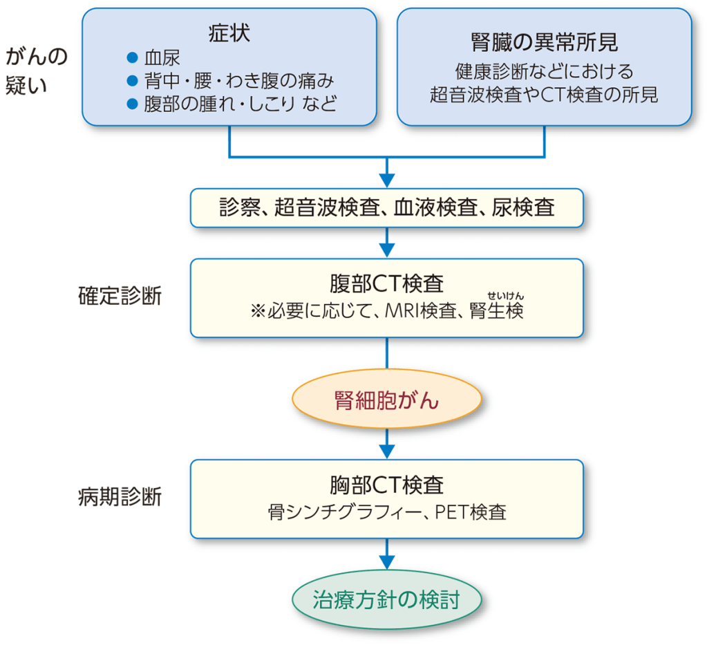 腎細胞がんの診断の流れ