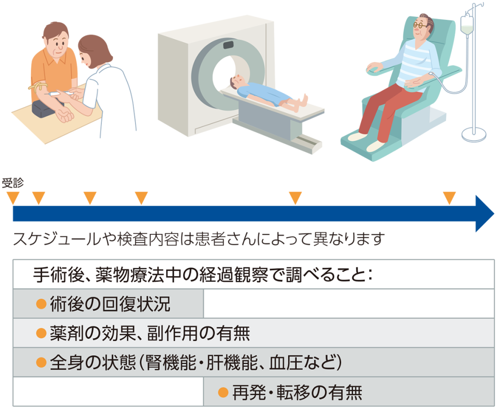 腎細胞がんの経過観察