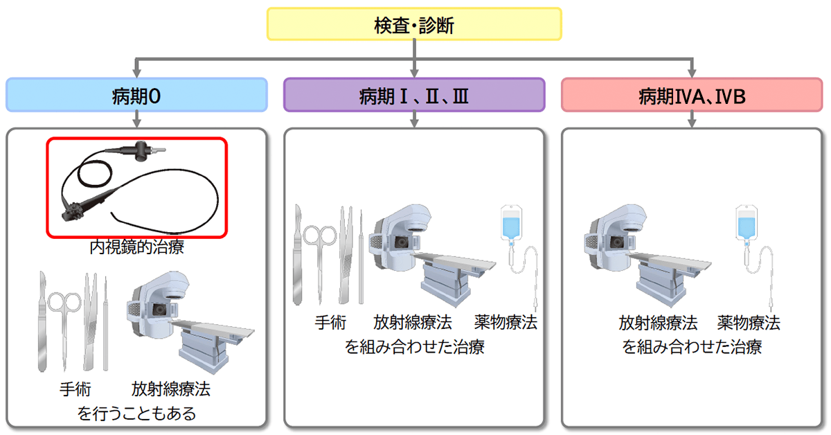 治療(手術、対症療法など) | 食道がん | MSD oncology がんを生きる