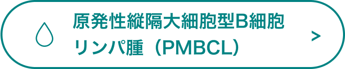 原発性縦隔大細胞型B細胞リンパ腫（PMBCL）