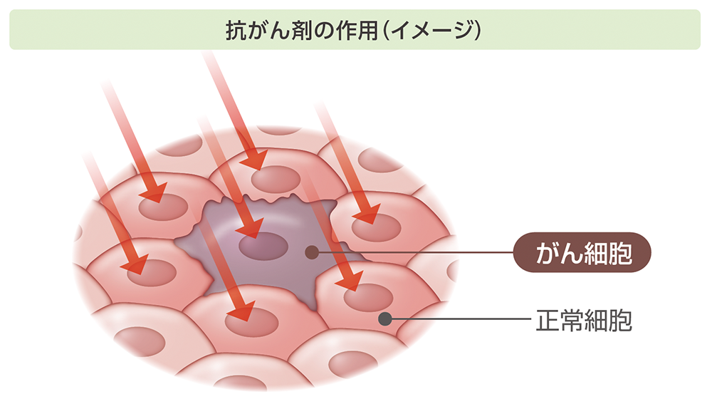 抗がん剤の作用のイメージ