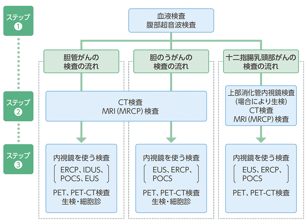 胆道がんの検査の流れのイメージ