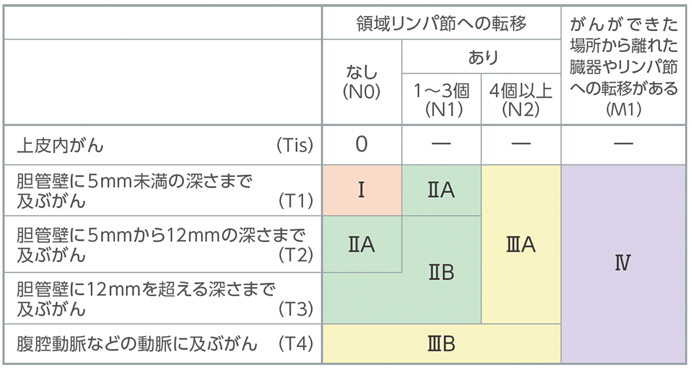 遠位胆管がんの病期分類の表​