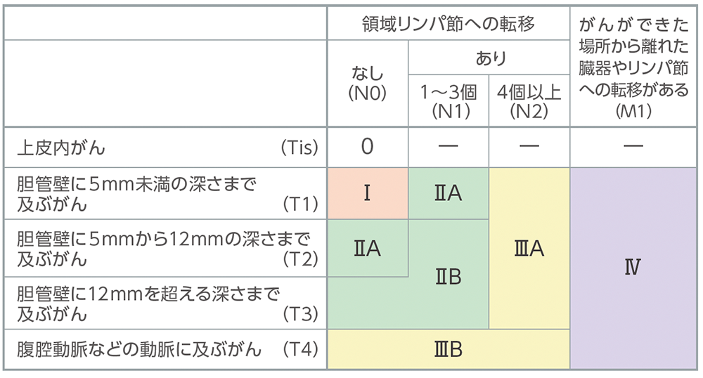 遠位胆管がんの病期分類の表