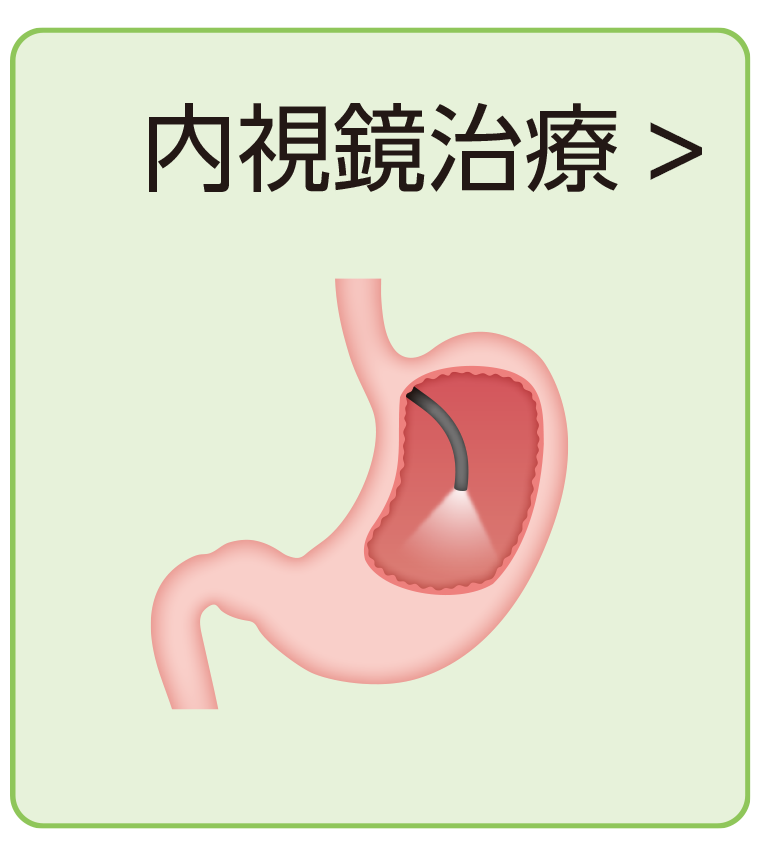 内視鏡治療