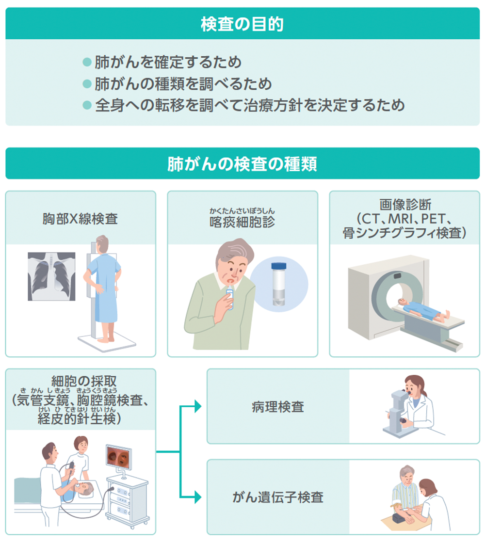 肺がんの検査の目的、肺がんの検査の種類