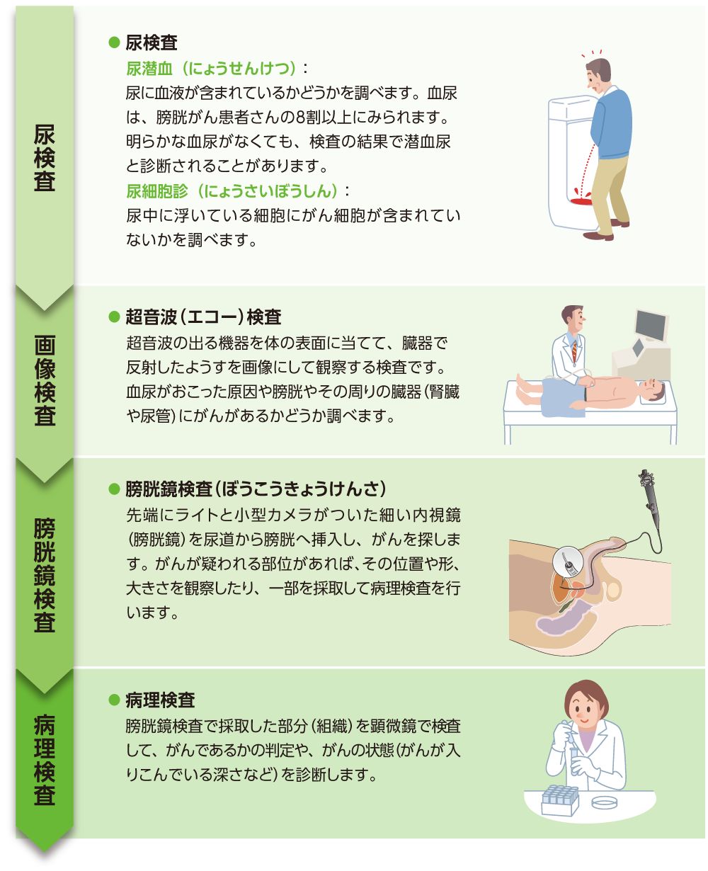膀胱がんの確定診断までの流れ