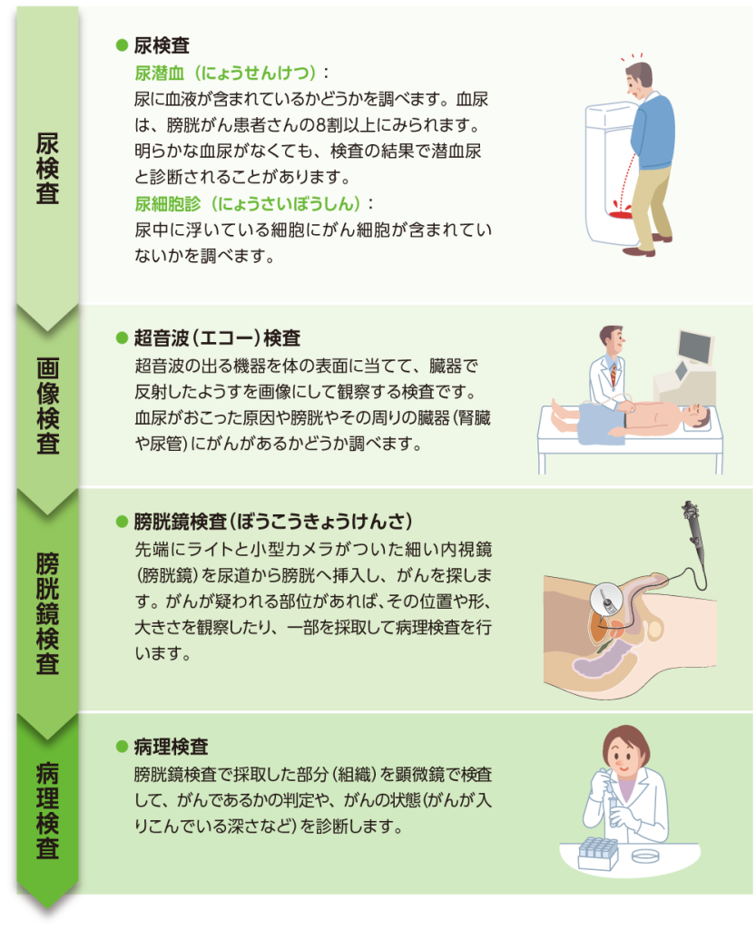 膀胱がんの確定診断までの流れ