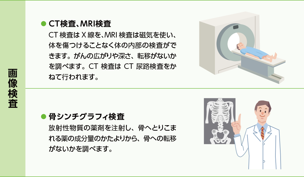 膀胱がんの治療方針を決めるための検査