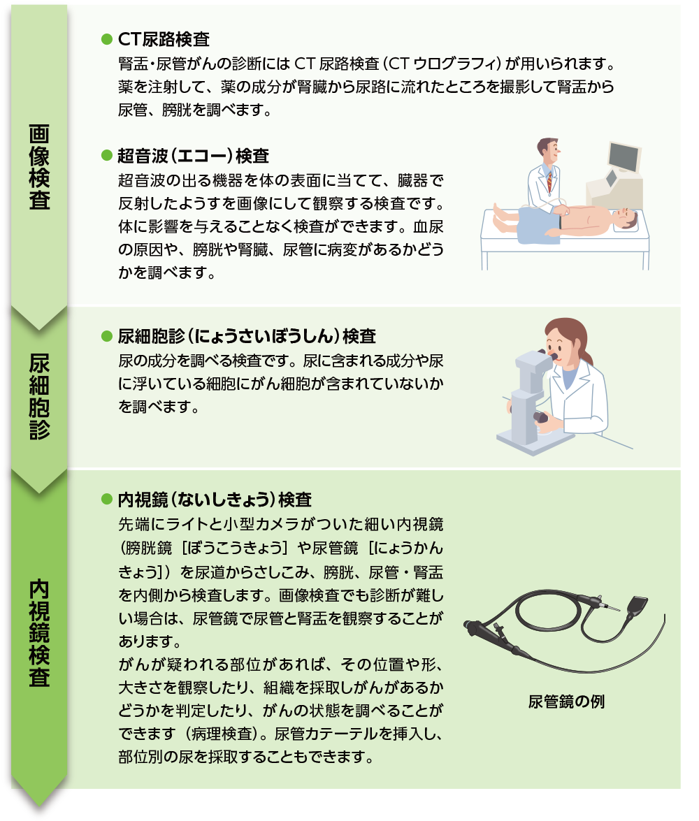 腎盂・尿管がんの確定診断までの流れ