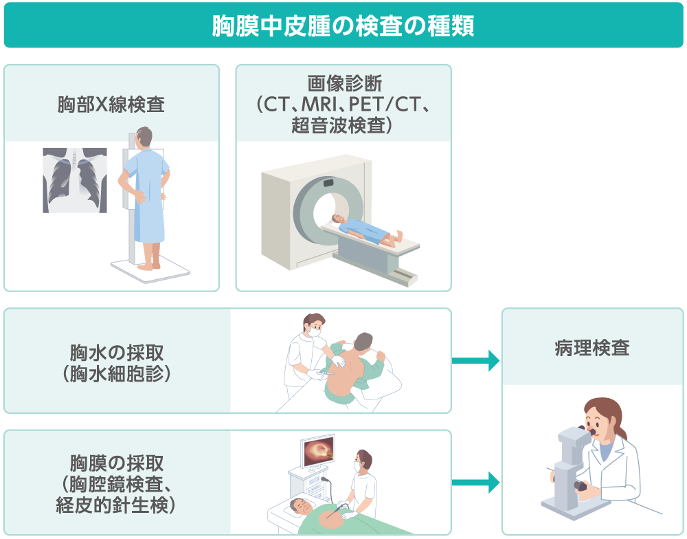 胸膜中皮腫の検査のイラスト