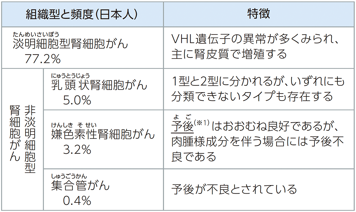腎細胞がんの主な組織型分類